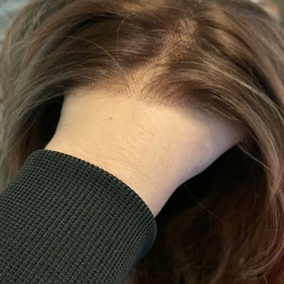 Ginger - Picture 6 of 6